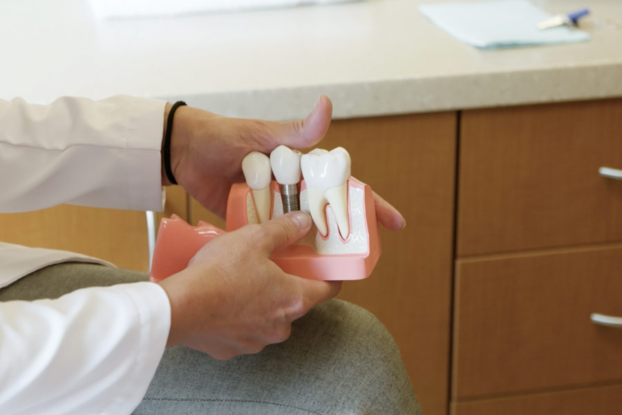 Dental Implants Dentist Grandville MI