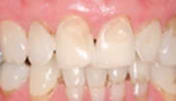 Grandville Mi Dentist Cosmetic Dentistry