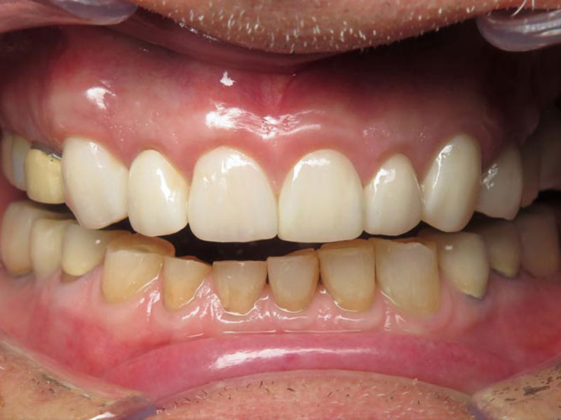 Orthodontic Dentist Grandville MI
