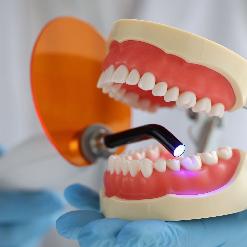Dental UV lamp completing a sealant