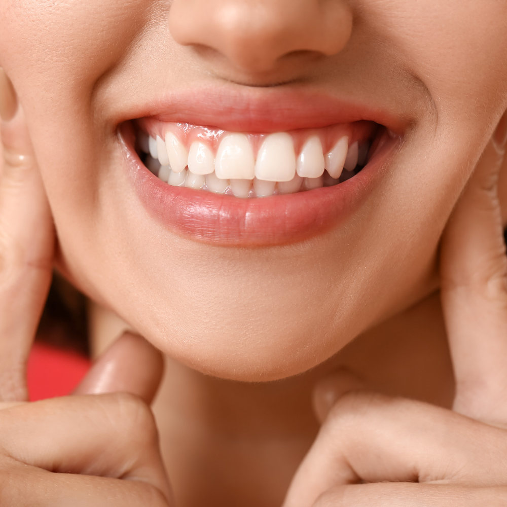 Woman smiling holding her cheeks